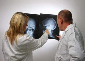 Radiología Alameda medicos con radiografías